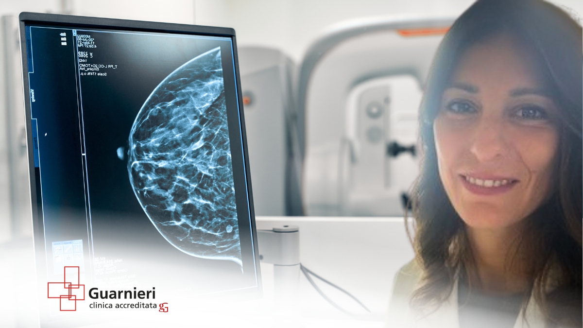 risonanza magnetica mammaria roma