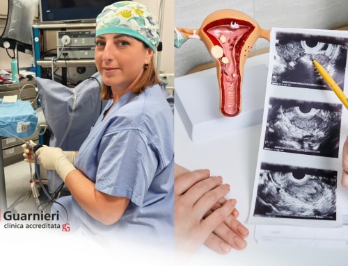 Isteroscopia diagnostica a Roma: quando eseguirla?