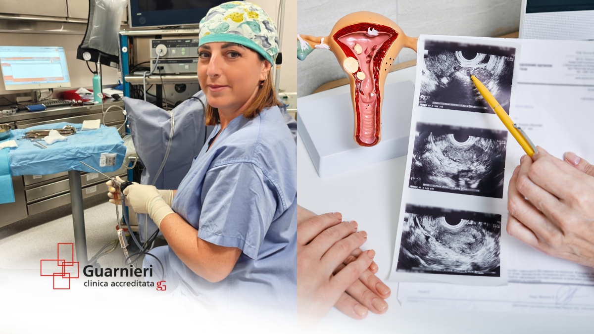 isteroscopia diagnostica roma