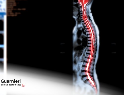 Chirurgia Robotica Spinale: Perché scegliere la Clinica Guarnieri